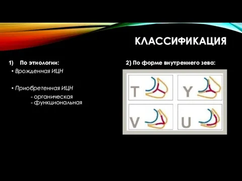 КЛАССИФИКАЦИЯ По этиологии: Врожденная ИЦН Приобретенная ИЦН - органическая - функциональная 2) По форме внутреннего зева: