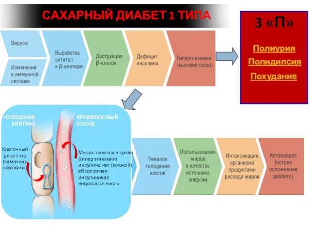 3 «П» Полиурия Полидипсия Похудание САХАРНЫЙ ДИАБЕТ 1 ТИПА