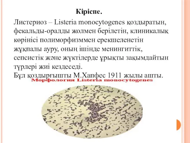 Кіріспе. Листериоз – Listeria monocytogenes қоздыратын, фекальды-оралды жолмен берілетін, клиникалық