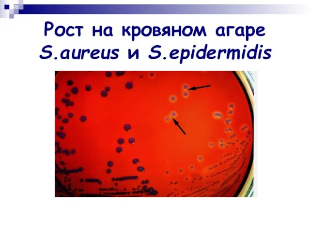 Рост на кровяном агаре S.aureus и S.epidermidis