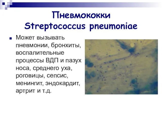 Пневмококки Streptococcus pneumoniae Может вызывать пневмонии, бронхиты, воспалительные процессы ВДП и пазух носа,