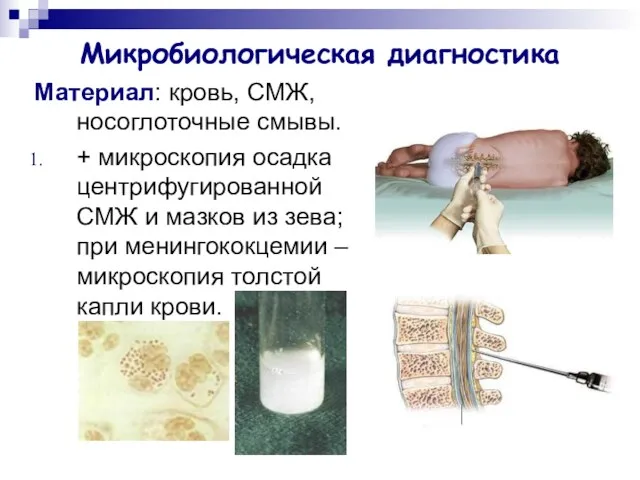 Микробиологическая диагностика Материал: кровь, СМЖ, носоглоточные смывы. + микроскопия осадка центрифугированной СМЖ и