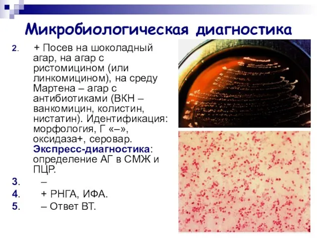 Микробиологическая диагностика 2. + Посев на шоколадный агар, на агар с ристомицином (или