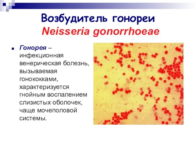 Возбудитель гонореи Neisseria gonorrhoeae Гонорея – инфекционная венерическая болезнь, вызываемая гонококками, характеризуется гнойным