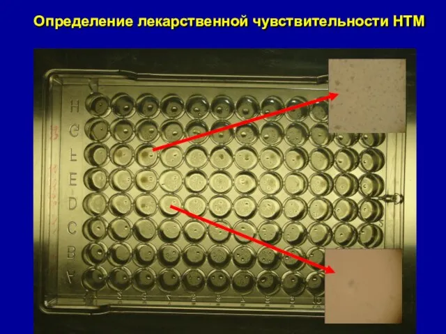 Определение лекарственной чувствительности НТМ