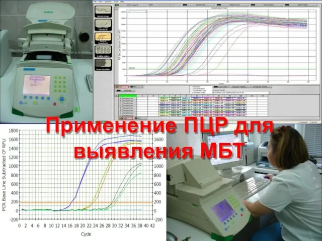 Применение ПЦР для выявления МБТ