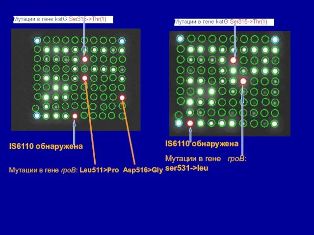 IS6110 обнаружена IS6110 обнаружена Мутации в гене rpoB: ser531->leu Мутации в гене rpoB: Leu511>Pro Asp516>Gly