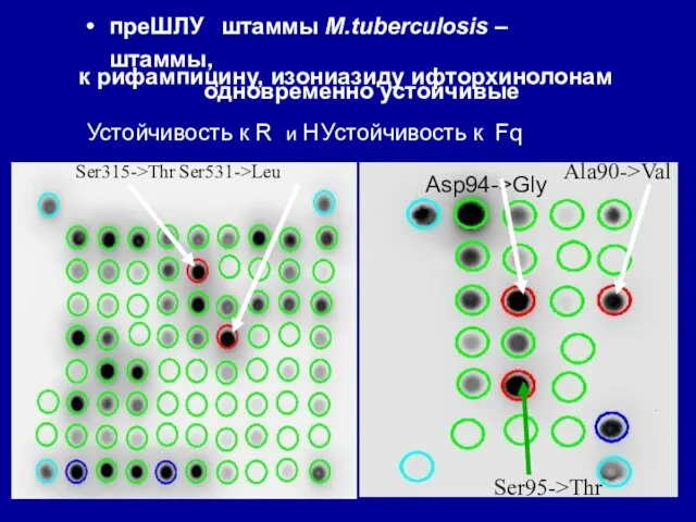 Asp94->Gly Ala90->Val Ser315->Thr Ser531->Leu к рифампицину, изониазиду и фторхинолонам Устойчивость