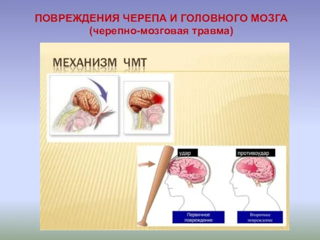 ПОВРЕЖДЕНИЯ ЧЕРЕПА И ГОЛОВНОГО МОЗГА (черепно-мозговая травма)