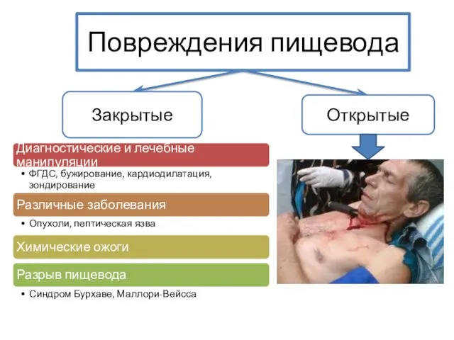 Повреждения пищевода Закрытые Открытые