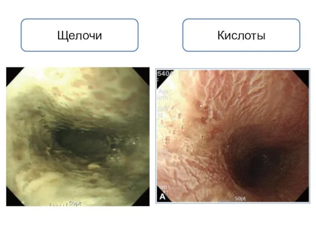 Щелочи Кислоты