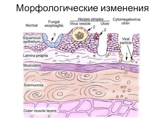 Морфологические изменения