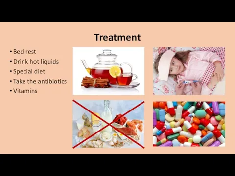 Treatment Bed rest Drink hot liquids Special diet Take the antibiotics Vitamins