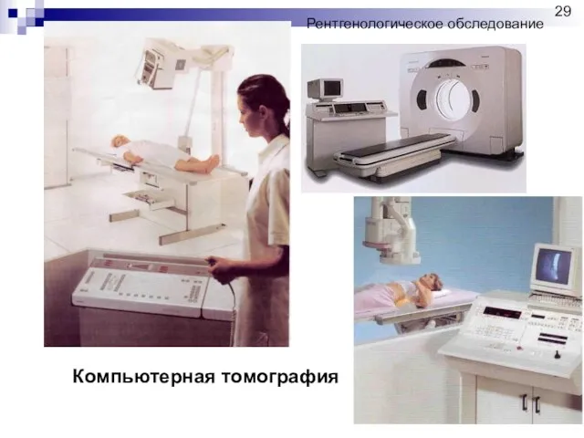 Компьютерная томография Рентгенологическое обследование 29
