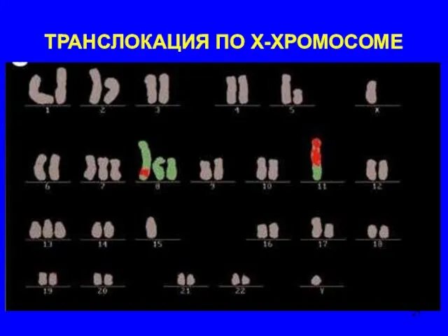 ТРАНСЛОКАЦИЯ ПО Х-ХРОМОСОМЕ