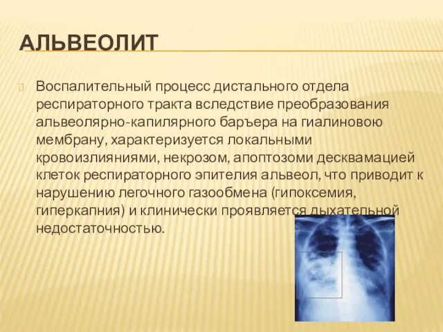 АЛЬВЕОЛИТ Воспалительный процесс дистального отдела респираторного тракта вследствие преобразования альвеолярно-капилярного