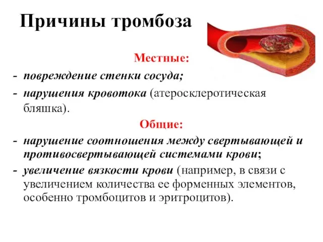 Причины тромбоза Местные: повреждение стенки сосуда; нарушения кровотока (атеросклеротическая бляшка).