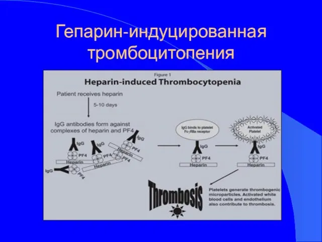 Гепарин-индуцированная тромбоцитопения