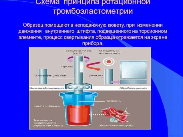 Схема принципа ротационной тромбоэластометрии Образец помещают в неподвижную кювету, при