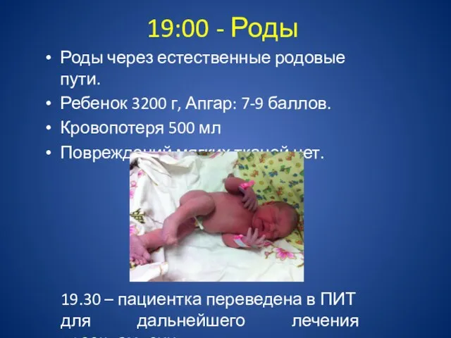 19:00 - Роды Роды через естественные родовые пути. Ребенок 3200 г, Апгар: 7-9
