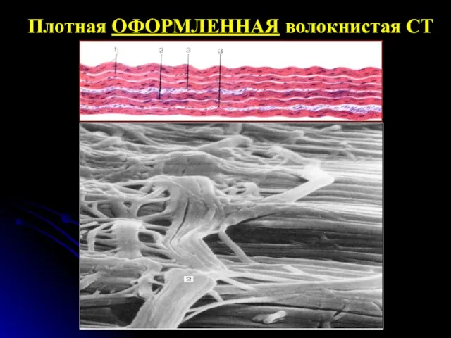 Плотная ОФОРМЛЕННАЯ волокнистая СТ