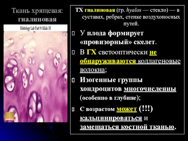 Ткань хрящевая: гиалиновая ТХ гиалиновая (гр. hyalos — стекло) —