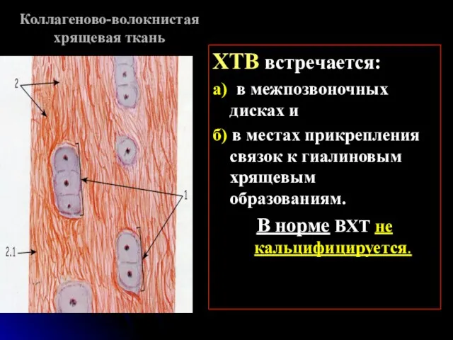 Коллагеново-волокнистая хрящевая ткань ХТВ встречается: а) в межпозвоночных дисках и