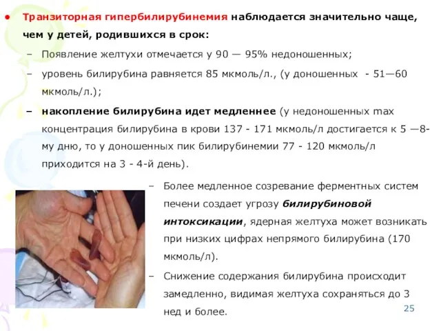 Транзиторная гипербилирубинемия наблюдается значительно чаще, чем у детей, родившихся в