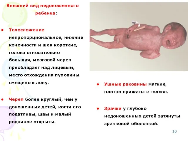 Внешний вид недоношенного ребенка: Телосложение непропорциональное, нижние конечности и шея