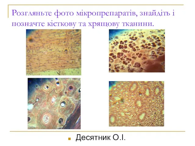 Десятник О.І. Розгляньте фото мікропрепаратів, знайдіть і позначте кісткову та хрящову тканини.