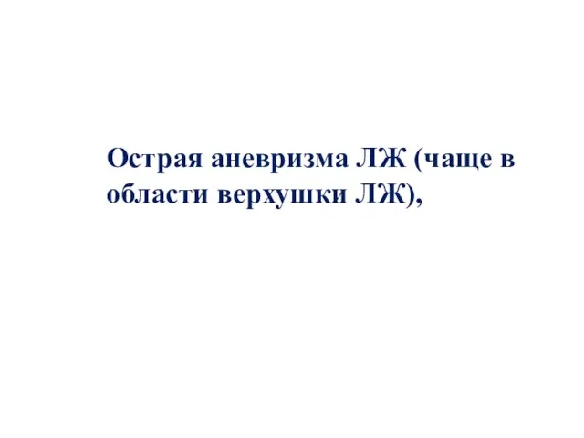 Острая аневризма ЛЖ (чаще в области верхушки ЛЖ),