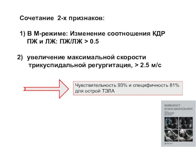 Сочетание 2-х признаков: 1) В М-режиме: Изменение соотношения КДР ПЖ