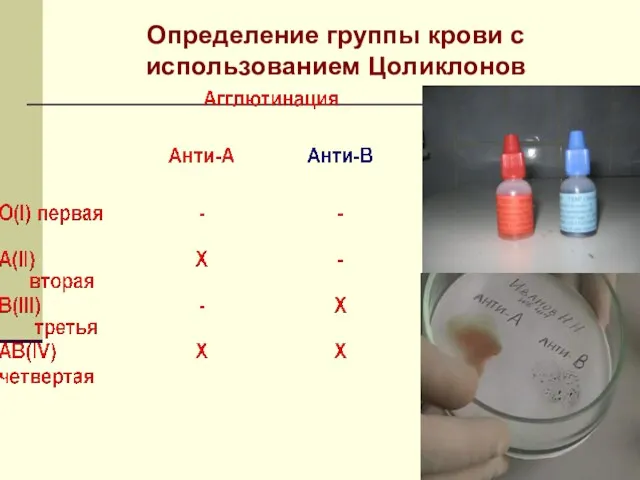 Определение группы крови с использованием Цоликлонов