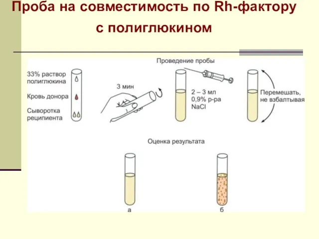 Проба на совместимость по Rh-фактору с полиглюкином