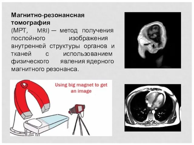 Магнитно-резонансная томография (МРТ, MRI) — метод получения послойного изображения внутренней