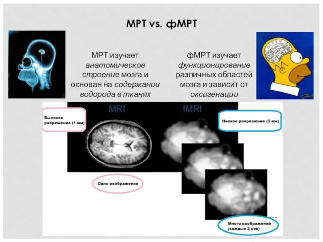 МРТ vs. фМРТ МРТ изучает анатомическое строение мозга и основан