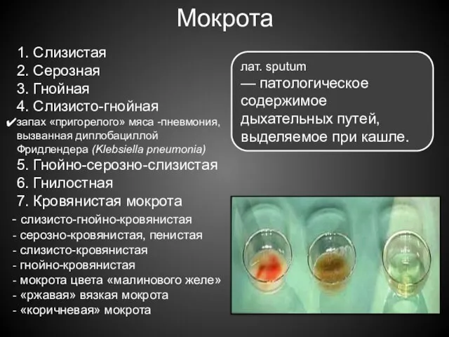 Мокрота 1. Слизистая 2. Серозная 3. Гнойная 4. Слизисто-гнойная запах «пригорелого» мяса -пневмония,