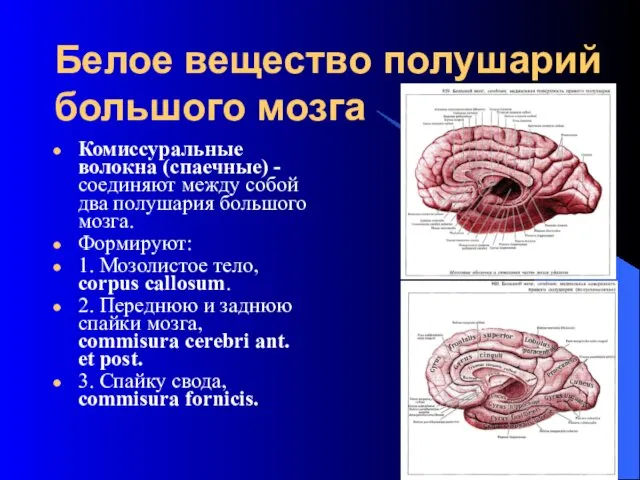 Белое вещество полушарий большого мозга Комиссуральные волокна (спаечные) - соединяют