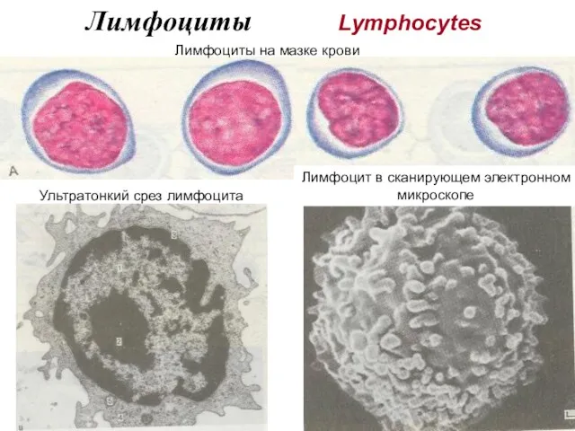 Лимфоциты Lymphocytes Ультратонкий срез лимфоцита Лимфоцит в сканирующем электронном микроскопе Лимфоциты на мазке крови