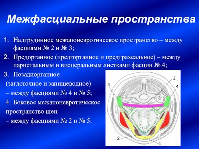 Межфасциальные пространства Надгрудинное межапоневротическое пространство – между фасциями № 2