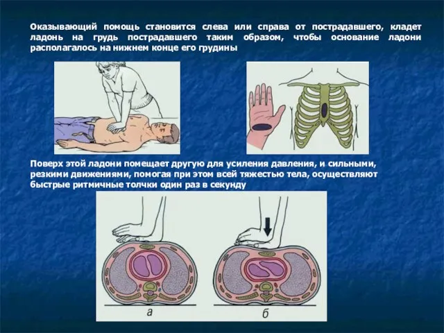 Оказывающий помощь становится слева или справа от пострадавшего, кладет ладонь на грудь пострадавшего
