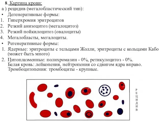 8. Картина крови: а ) рецидив (мегалобластический тип): • Дегенеративные