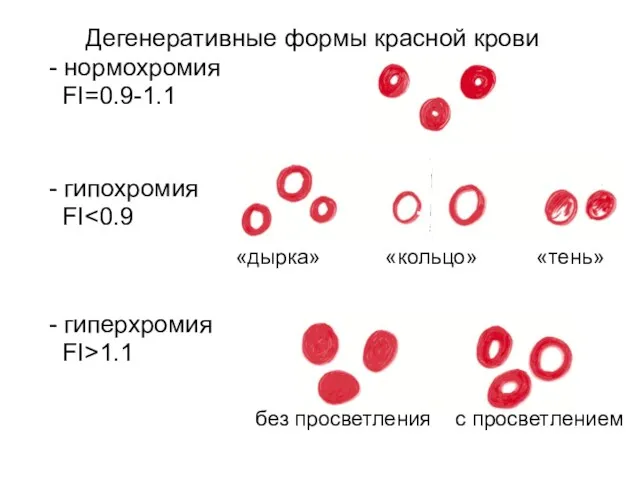 Дегенеративные формы красной крови - нормохромия FI=0.9-1.1 - гипохромия FI