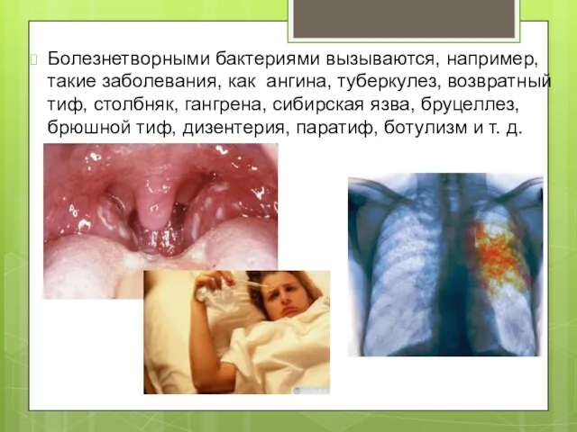 Болезнетворными бактериями вызываются, например, такие заболевания, как ангина, туберкулез, возвратный