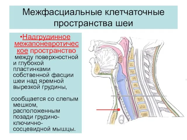 Межфасциальные клетчаточные пространства шеи Надгрудинное межапоневротическое пространство между поверхностной и