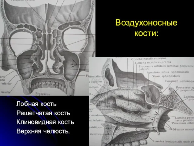 Воздухоносные кости: Лобная кость Решетчатая кость Клиновидная кость Верхняя челюсть.