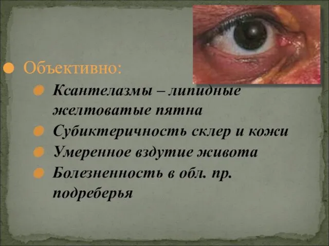 Объективно: Ксантелазмы – липидные желтоватые пятна Субиктеричность склер и кожи