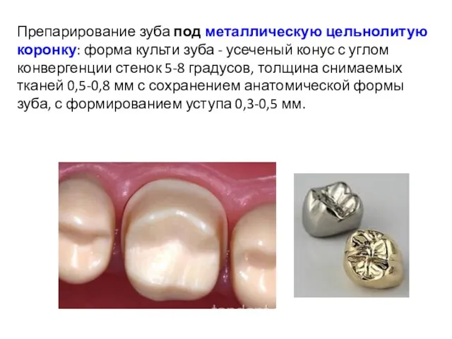 Препарирование зуба под металлическую цельнолитую коронку: форма культи зуба - усеченый конус с