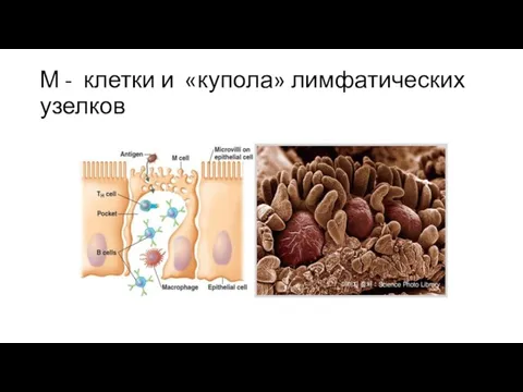 М - клетки и «купола» лимфатических узелков