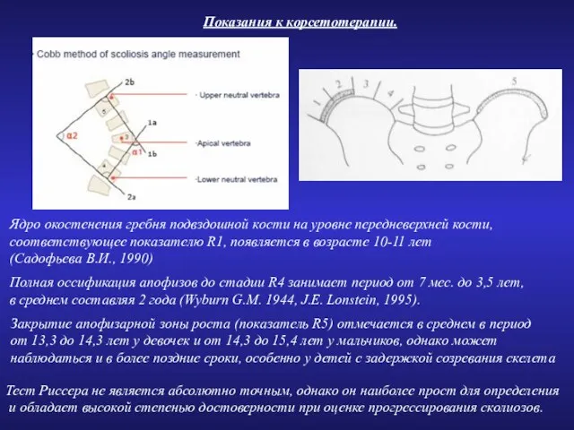 Ядро окостенения гребня подвздошной кости на уровне передневерхней кости, соответствующее